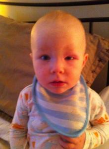 Puffy Eye